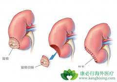 �������ڳ��˳��������ỹ�ɳ�ʲô��