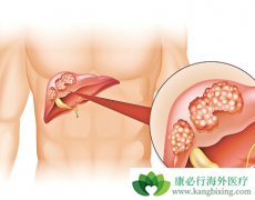 �Ҹβ�����Ⱦ�ܹ�����ԭ���Ըΰ���