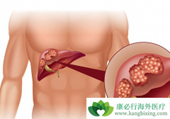 �Ҹ�����ĳ��ֶ����й��ΰ��ķ������л�����