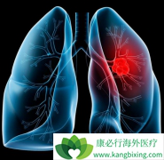 ��λ���ΰ�����֢״���Ƕ�֢���ƻ��ǿ��������ƣ�