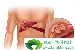 �ΰ�����֢״��ɶ���֣���Щ�����׵øΰ���