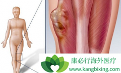 ֬��������֬������Ƚ��к�����