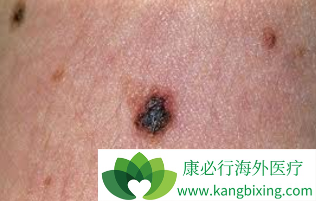 ���Ժ�ɫ����