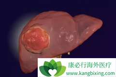 �ΰ��������κ�������ʱ��Ҫ�����ļ��㣿