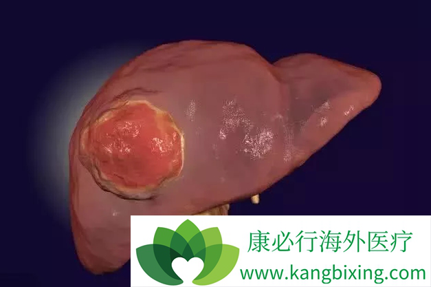 �ΰ��������κ���