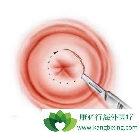 ��������ԭ��