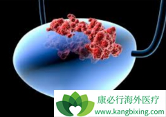 ���ڰ��װ�֢״������Щ��