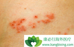 ʹ�ð���ҩ��֮�����Ƥ����ô���ƣ�