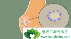 ����Ů��ʹ��˫�����κ����ǵ��͹ɹǹ��۵ķ��ո���