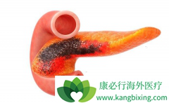 ���ٰ�����֢״ͨ��������Щ��