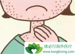 ������Ƥ����������Լ��ܷ񻺽�Ȭ����