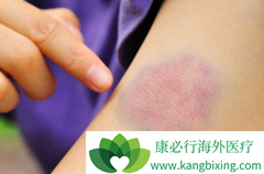 ���������Щ���׿���������Ѫ����֢״��