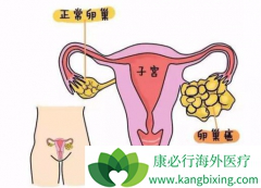 �ѳ���������ʲô���ѳ���������֢״����Щ��