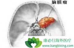 ����ж���������֮�����費��Ҫ���ܻ��ƣ�