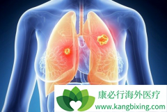 �ΰ�����֢״����Щ������Щ���Ʒ�������ѡ��