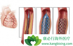 ����֧��������ƭ����������֧���������������