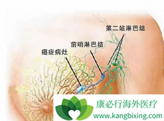 ���ٰ����ڵı�׼��ʲô����ͬ���ڵ����Ʒ������ѡ��