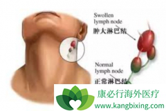 �ǻ�����ܰ���֢״����ͨ������Щ��