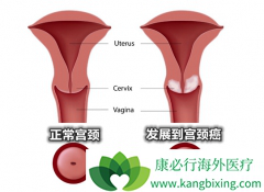 �����շ���������ԭ��ͨ������Щ��