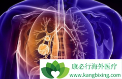 ���ڷΰ����ߵķ��Ӱ������ƺͻ���