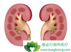 ����ת����ʲô֢״������Щ����ҩ�ԣ�