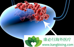 ��Щ���װ����ڻ��߿�ѡ�����������ƣ�