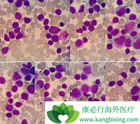 ��ͬ�׶ε�������Ѫ�������Ʒ����кβ�ͬ��