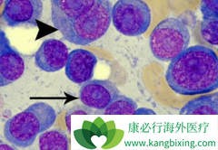 �෢�Թ������������ѡ��ASCT����ʱ����