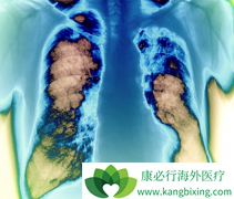 �������������Ƽ�Ƥ��Ч����ô����