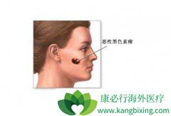 �����������Ƶĺ�ɫ���������������ж�ã�