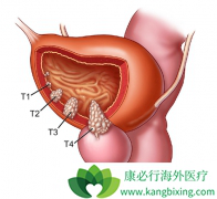 ���װ�֢״�Ͱ��װ�����ҩ��ѡ��