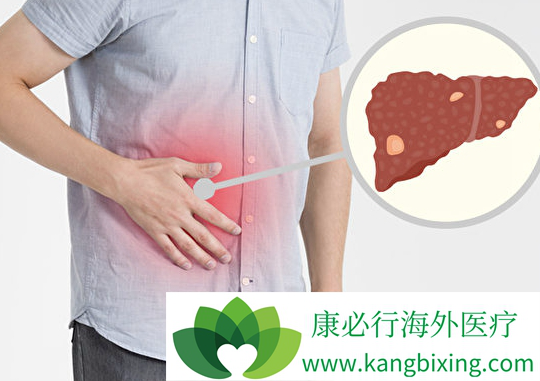 肝细胞癌 肝细胞癌