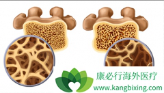 ˫�����ζԶ�ͯ�ɹǲ�ȫ֢��Ч��ô����