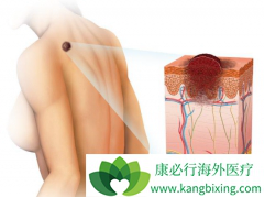 ����ϸ������һ�������ʺܸߵ�Ƥ������