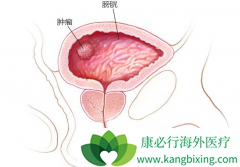 Ѫ���ǲ��ǰ��װ�֢״֮һ��