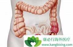 ��ֱ�������ٰ�Ӧ�����ɸ�飿�������ɸ���ֱ�������ߣ�