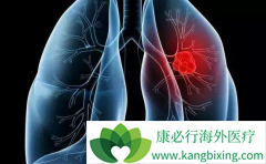 TKI�����ڷΰ��¸�������������������Щ���⣿