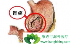 ������ת����θ��������ҩ������Щ��