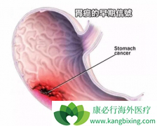θ������֢״����ͨ������Щ��