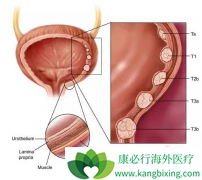 HER2���Ե���·��Ƥ�������ܹ�ʹ��ʲôҩ�����ƣ�