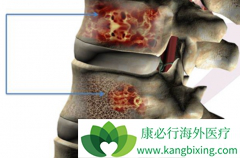 �෢�Թ�����/���谩���׷�֢״ǧ�����