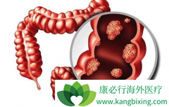 ߻���������ڽ�ֱ��������Щ�洦��