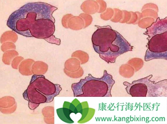 �෢�Թ�����֢״���ָ��Ӷ��ȱ��������