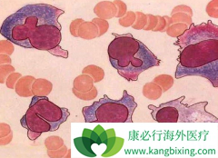 ��������ת������Щ֢״������жϹ�ת�ƣ�