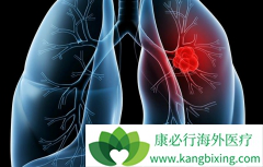 �������ڷΰ������ܴӱ������������л�����