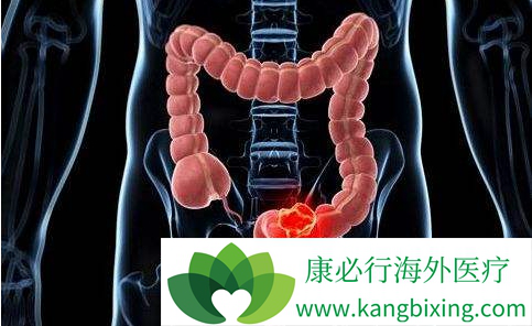 ��ֱ����