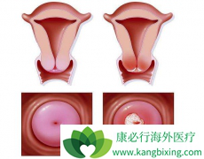 ���������ڻ򸴷����������Ƶķ��Ӱ���ҩ������Щ��