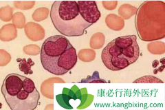 ������ά�����������ƹ����г���ͷ�η�����֢״�Ǻ�ԭ��