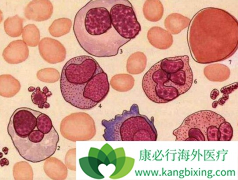 ���������쳣�ۺ�֢����ʱ�������Щ����֢��