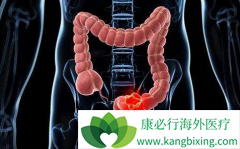 ߻��������Ϊ���ڽ�ֱ������������ҩ